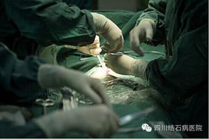 胆结石的手术方法是什么？(图2)