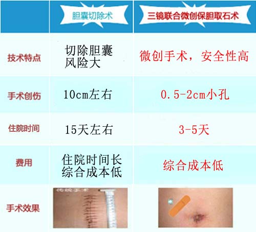 结石病应该怎么治疗？(图7)