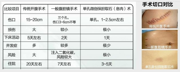 什么因素会诱发胆囊息肉呢？(图5)