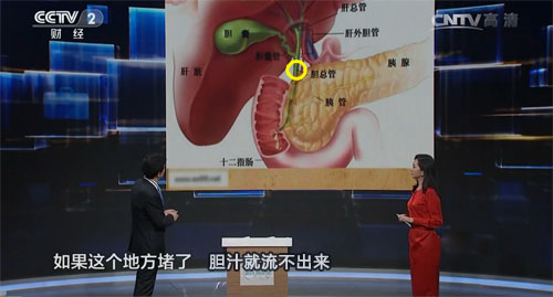 对号入座你可能得胆结石的原因！(图8)