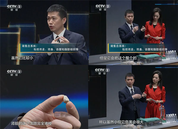 结石病6大症状需立即就医(图2)