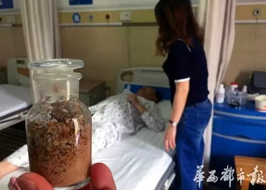 体外碎石200次无效，在这竟然一次治好了(图1)
