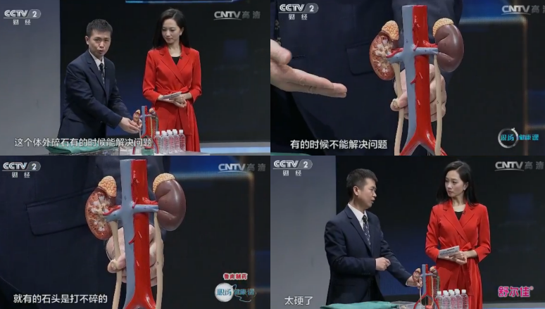 尿结石了，用体外碎石治疗合适吗？(图2)