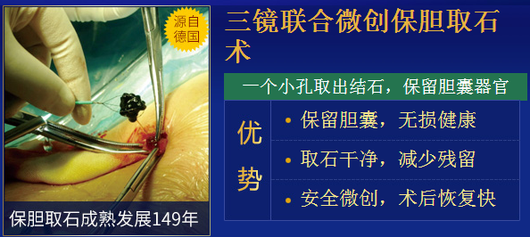 关于打结石，你该知道这些(图3)