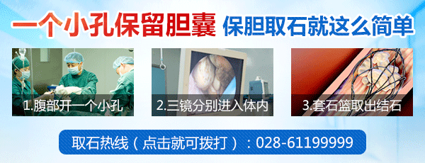 保胆取石，才是治疗胆结石的“良方”！(图8)