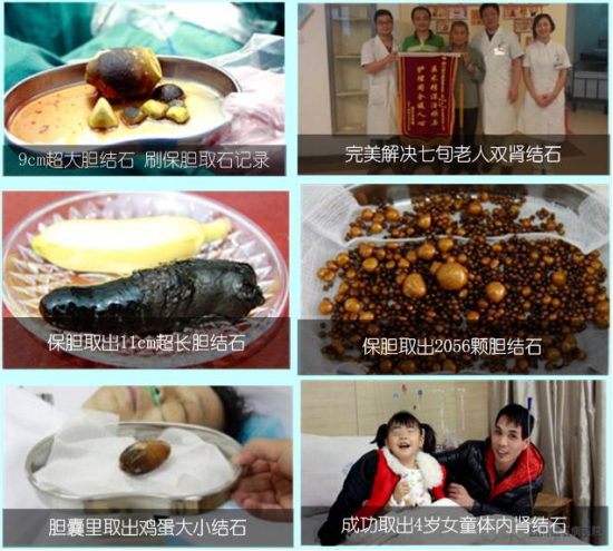 实力铸就口碑：33%的患者慕名就医(图2)